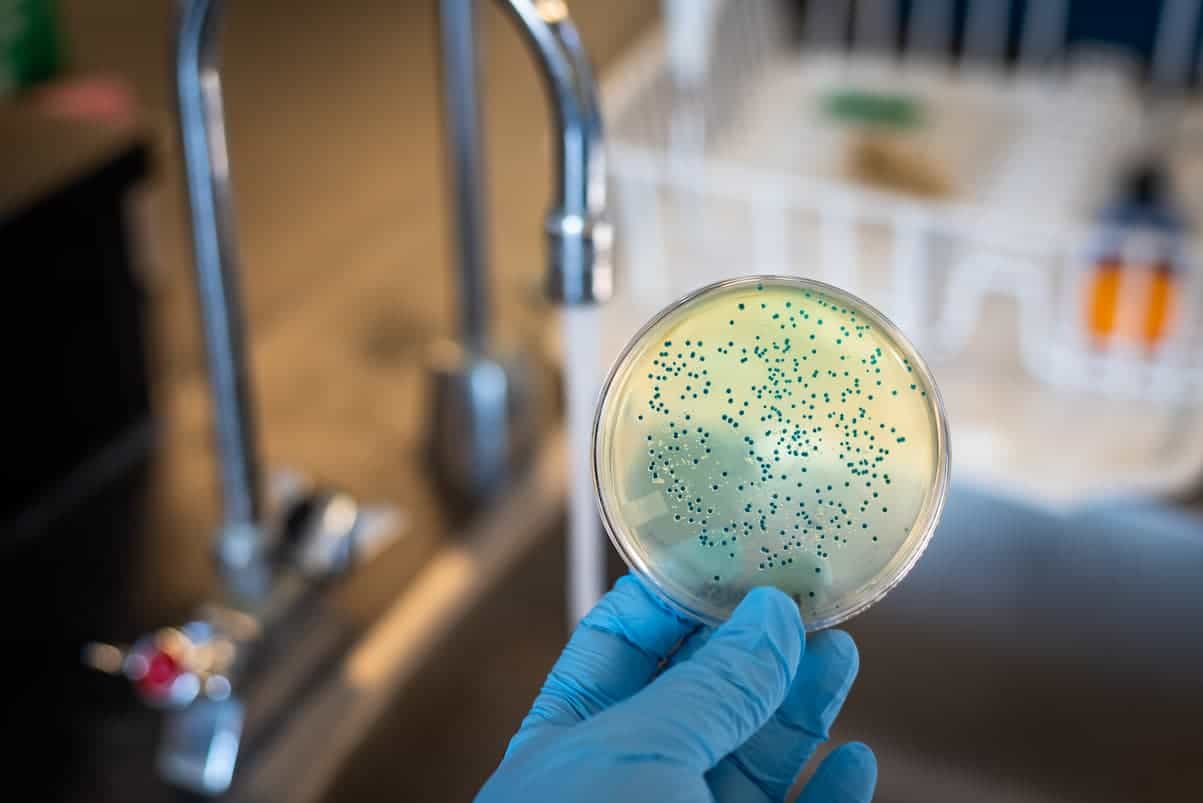 microbial contamination of food